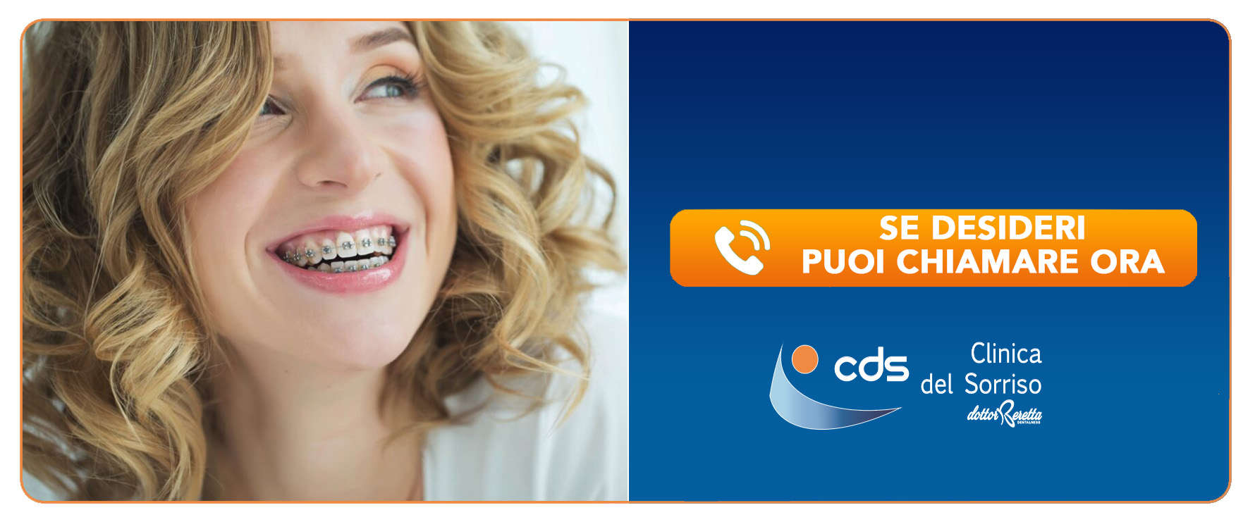 ortodonzia-fissa-apparecchio-dentale-fisso Torreglia Padova